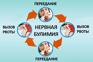 Лечение булимии в Николаевке